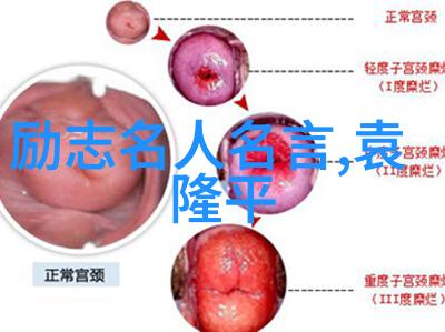 不和婆婆住的最好方法-和谐共处应对婆媳关系中的冲突策略